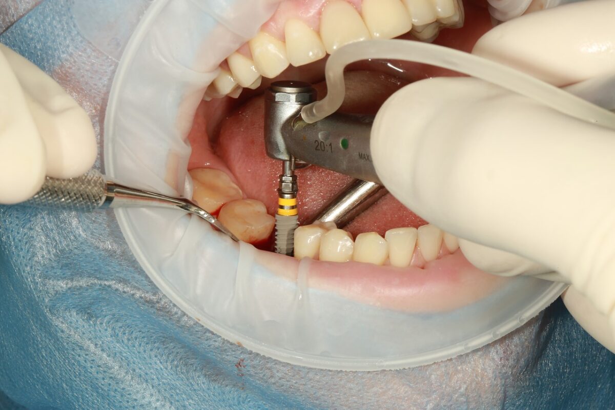 dental-3754769_1280-1200x800.jpg